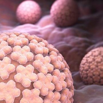 Infección por HPV | Mater Obstetricia y Ginecología | Reproducción Asistida